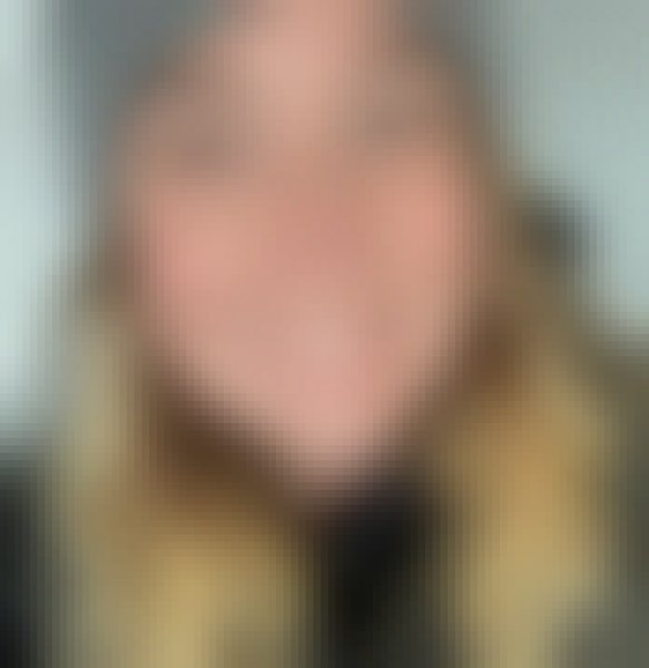 Dori, 39, Malawi