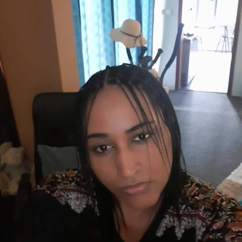 Mona Barbie, 30, Queimados